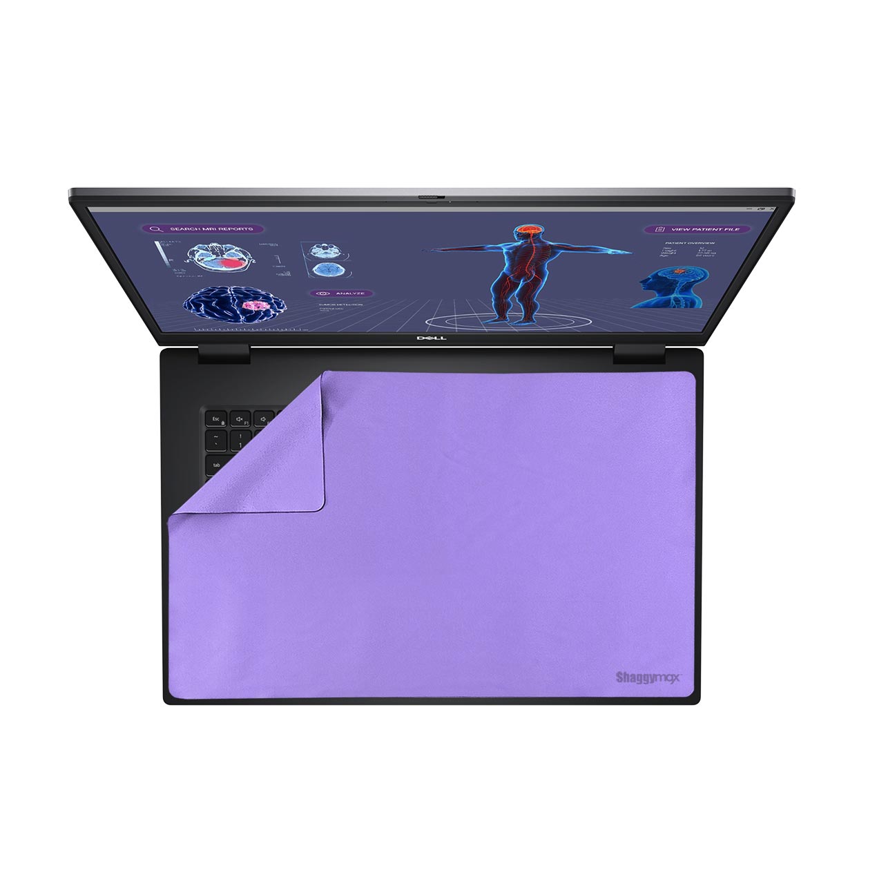 17" Custom Laptop Screen Protector Keyboard Cover Microfiber Wipe 3-in-1 -UnderWare